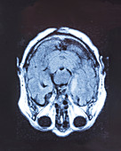Human brain, MRI scan