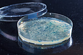 Colonies growing in Petri dish