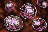 Cytomegalovirus infection, illustration