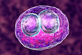 Cytomegalovirus infection, illustration