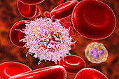 Lymphocyte in hairy cell leukaemia, illustration