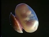 Rat embryo and capsule, light microscopy footage