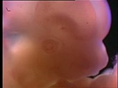 Rat embryo head, light microscopy footage