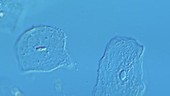 Cheek squamous epithelial cells, light microscopy