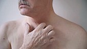 Man scratching neck and chest