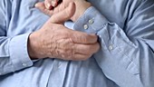 Man with itchy skin on arm