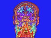 Human brain, rotating 3D MRI scan