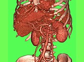 Human abdominal organs, rotating 3D CT scan