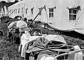 Sun treatment for wounds, France, 1918