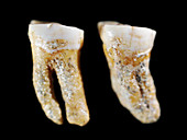 Neanderthal teeth