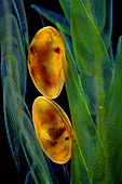 Ostracods on sphagnum moss, light micrograph