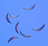 Mosquito wing scales, light micrograph