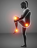 Woman with leg pain, illustration