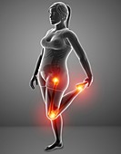 Woman with leg pain, illustration