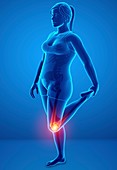 Woman with knee pain, illustration