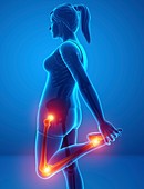 Woman with leg pain, illustration