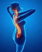 Woman with back pain, illustration