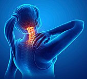 Woman with neck pain, illustration