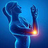 Woman with wrist pain, illustration