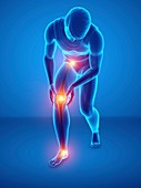 Man with knee pain, illustration