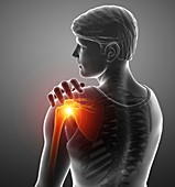 Man with shoulder pain, illustration