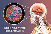 Encephalitis caused by West Nile virus, illustration