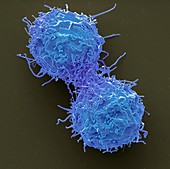 Dividing leukaemia cell, SEM