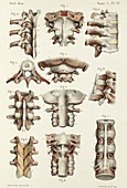 Spinal joints anatomy, 1866 illustrations