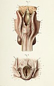 Larynx anatomy, 1866 illustrations