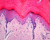 Skin epidermis, light micrograph