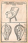 Birthing chair and foetal positions, 16th century