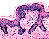 Nipple skin, light micrograph