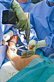 Total ankle replacement surgery