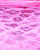 Granular layer of epidermis, light micrograph