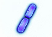 Kingella kingae bacteria, TEM