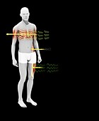 Radiation effects on humans, illustration