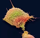 Cervical cancer cell, SEM