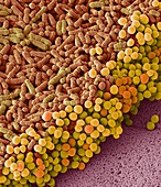 Fecal bacteria, SEM