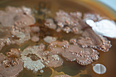 Colonies of bacteria in Petri dish