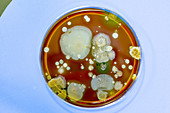 Microbes growing in Petri dish