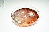 Bacterial colonies growing in Petri dish