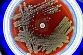 Petri dish with colonies of microbes