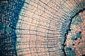 Plant tissue, light micrograph