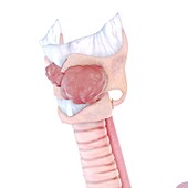 Illustration of larynx cancer