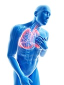 Illustration of a man with an inflamed lung