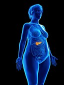 Illustration of an obese woman's pancreas