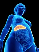 Illustration of an obese woman's liver