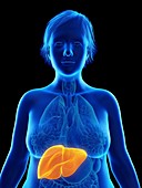 Illustration of an obese woman's liver