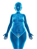Illustration of an obese woman's bladder