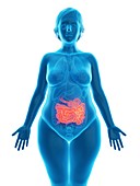 Illustration of an obese woman's small intestine